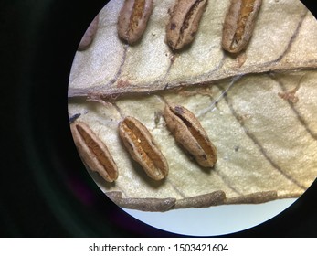 Group Of Sporangium Called Synangium Or Sporocarp In Fern Of Family Marattiaceae, Order Marattiales Under Stereo Microscope.