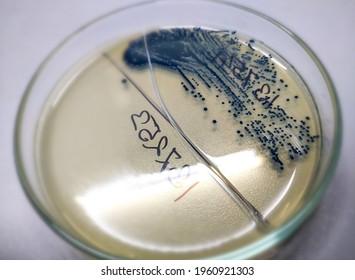 Growing Bacteria In Agar Medium In Microbiology Lab. Micro-organisms Enterobacter Grow Urine Samples.