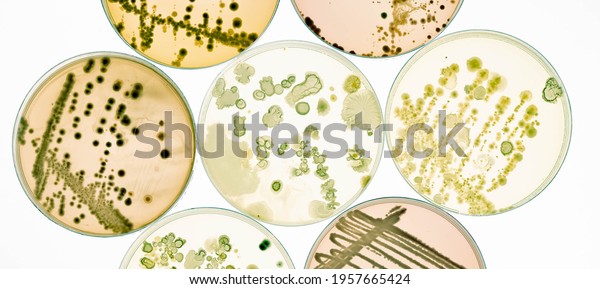 Growing Bacteria in Petri Dishes on agar gel\
Scientific experiment.