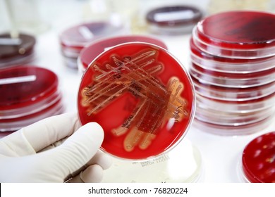 Growth of bacteria (Streptococcus) on blood agar in a laboratory.