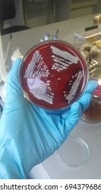 Growth Microorganisms On Blood Agar Stock Photo 694379686 | Shutterstock