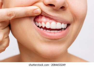 Gum Health. Cropped Shot Of A Young Woman Showing Healthy Gums Isolated On A White Background. Dentistry, Dental Care	