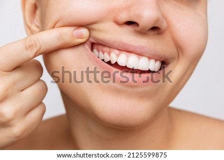 Gum health. Cropped shot of a young woman showing healthy gums. Dental care, dentistry concept