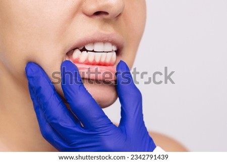 Gum inflammation. Young woman's face with doctor's hand in a blue glove on the jaw showing red bleeding painful gums isolated on gray background. Examination at the dentist. Dentistry, dental care