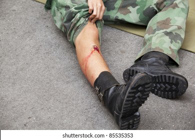 Gunshot Wound On Soldier's Leg