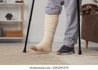 Guy is standing in the living room on crutches with bandaged leg. Unhealthy young man with broken leg or foot injury is undergoing rehabilitation at home. Photo of the lower body close-up at home.