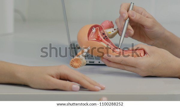 Gynecologist doctor consulting patient using uterus\
anatomy model