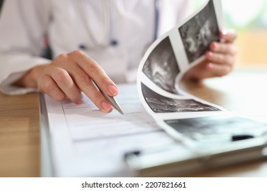 Gynecologist Examines Results Of Examination Of Uterus. Ultrasound Diagnostics Of Pelvic Organs