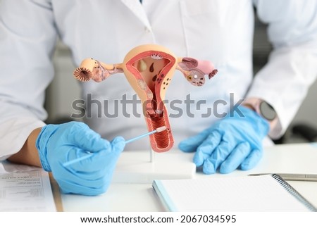 Gynecologist holds urogenital cytobrushes and model of female reproductive system