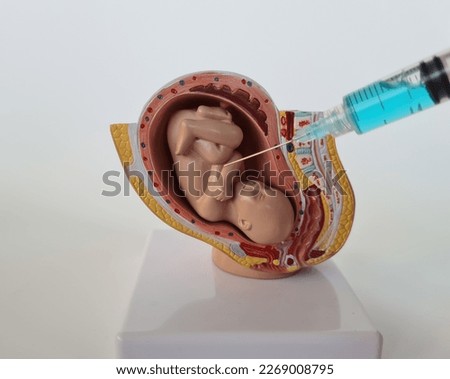 Gynecologist makes injection with syringe into embryo. Fetal gene therapy and stimulation in IVF