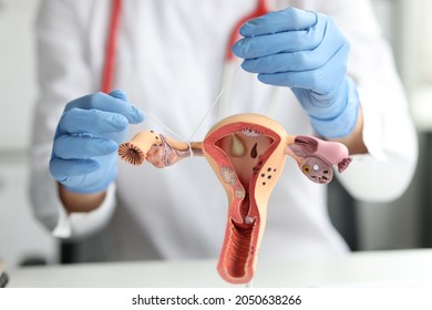 Gynecologist shows how to ligate the fallopian tubes on training model of female reproductive system