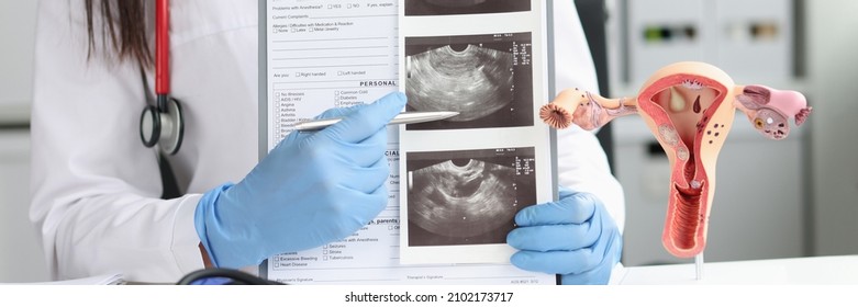 Gynecologist shows ultrasound of uterus in office. Instructional model of female reproductive system concept