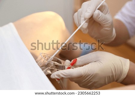 The gynecologist takes a vaginal swab for bacterial examination. Gynecological chair. A woman at the gynecologist for a check-up. 