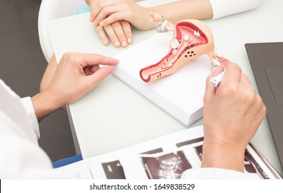 Gynecology, Women's Health. Close-up Of A Uterus Model