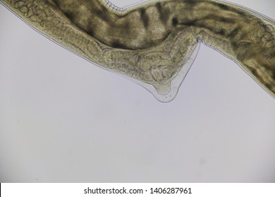 Haemonchus Contortus Under Microscope Foto de stock 1406287961 ...