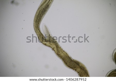 Haemonchus contortus under the microscope.