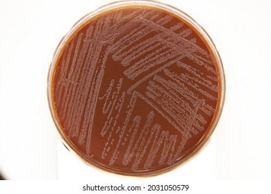 Haemophilus influenzae, a Gram negative bacilli (GNB), growing on chocolate blood agar (CBA) Petri plate. This bacteria is a respiratory pathogen that can be cultured in a microbiology laboratory.