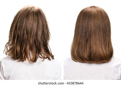 Hair Before And After Treatment.