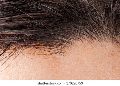 Receding Hairline Images Stock Photos Vectors Shutterstock