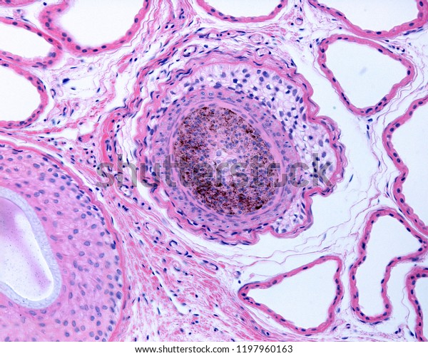 Hair Medulla Cortex And Cuticle - Micropedia