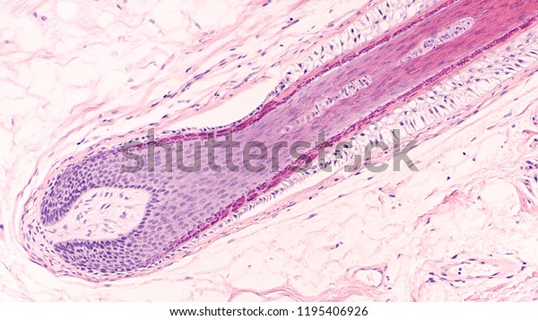 Hair Follicle Which Resides Dermal Layer Stock Photo Edit Now