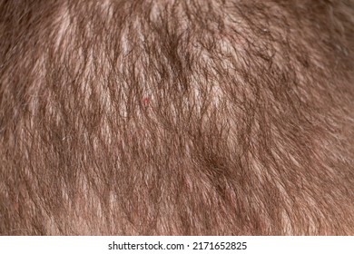 Hair Loss Adult Man On A Back Of Head. Irritated Scalp Skin.