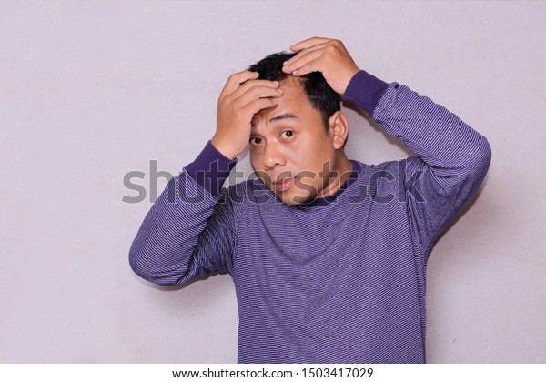 Hair Loss Asian Man Looking Touching Stock Photo Edit Now 1503417029