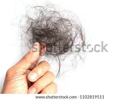 Hair loss, hair fall.