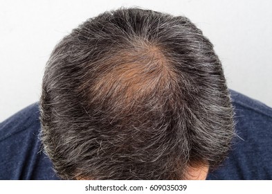 37,971 Bald head man Stock Photos, Images & Photography | Shutterstock