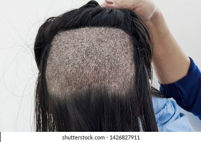 Bilder Stockfoton Och Vektorer Med Back Of Bald Head Shutterstock