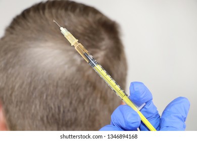 Hair Mesotherapy Or Hair Transplant: A Beautician Doctor Makes Injections In The Man’s Head For Hair Growth Or To Prevent Baldness