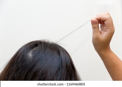 Hair Pulling Disorder Or Trichotillomania In Teenager Women Mental Health Problem.