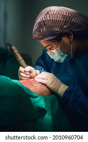 Hair Transplant Surgery Due To Hair Loss Symptoms.