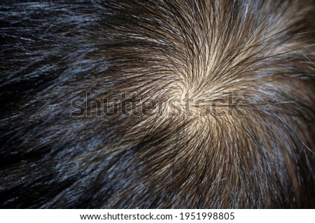 A hair whorl, a circular direction around center point on the human head, selected focus