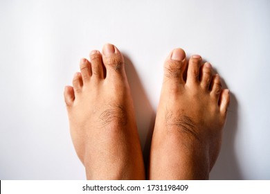 Hairy Feet Of An Adult Man On A White Wall