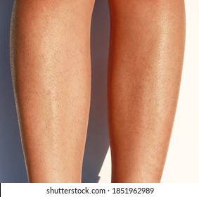 Hairy Female Legs On A White Background. Hair On The Legs. Legs To Knees
