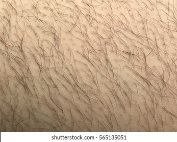 Hairy Legs