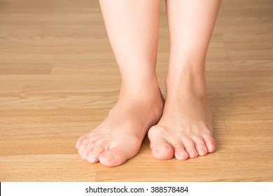 Hallux Valgus, Bunion In Foot.