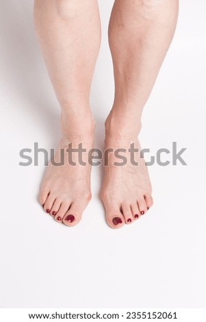 Hallux valgus on female legs on a white background. A bump on female legs close-up.