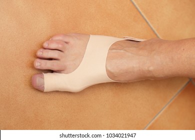 Hallux Valgus Treatment