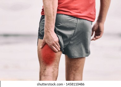 Hamstring Pain Pulled Muscle On Back Thigh Painful Red Area Athlete Man Massaging Sports Injury Fitness Cramp Muscles.
