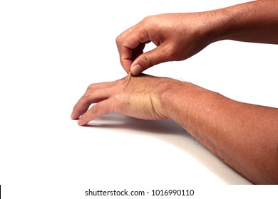 Hand Of Adult Asian Man  Pull The Back Hand Skin  On White Background Isolated