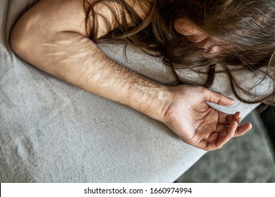 Hand, arm and hair of a Woman with heavy Cuts and scars of self-mutilation in frustration, self-abusing, Borderline personality disorder, copy space
