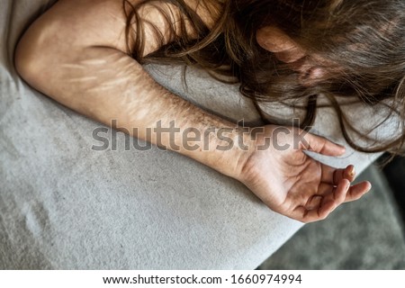 Hand, arm and hair of a Woman with heavy Cuts and scars of self-mutilation in frustration, self-abusing, Borderline personality disorder, copy space

