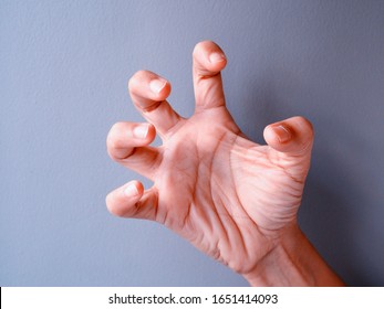 Hand Of Asian Woman With Spasms Hand And Twitches Posture, Hand Tense.