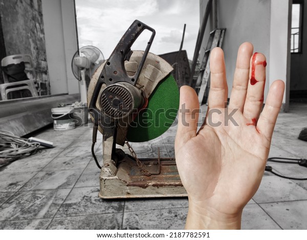 hand bleeding from the wound\
Accident from electric fiber cutting machine accident\
concept
