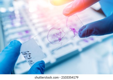 Hand In Blue Glove Holding Glass Histology Slides