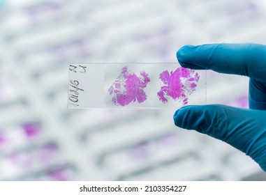 Hand In Blue Glove Holding Glass Histology Slides