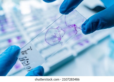 Hand In Blue Glove Holding Glass Histology Slides