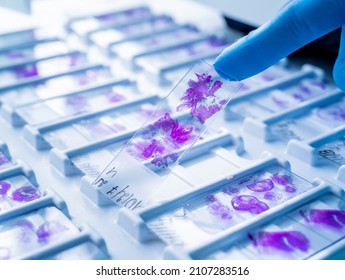 Hand in blue glove holding glass histology slides - Shutterstock ID 2107283516